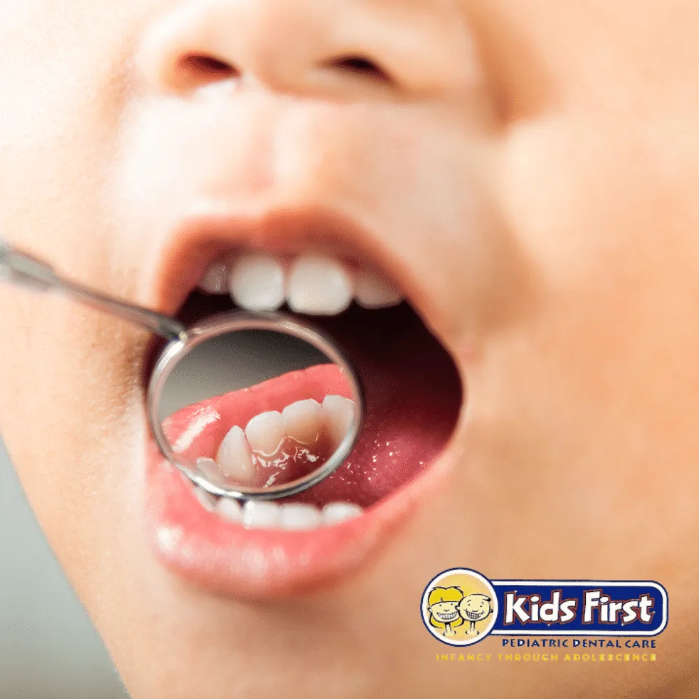 Illustration for Gum Disease in Children-How to Spot the Signs.