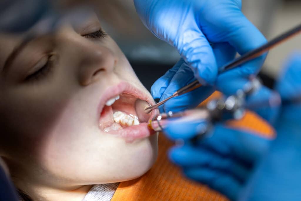 cavities
